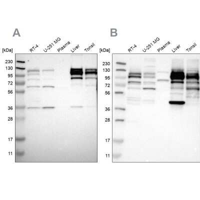 Western Blot: RRBP1 Antibody [NBP1-83958]
