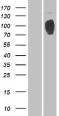 Western Blot: RRBP1 Overexpression Lysate [NBP2-07851]