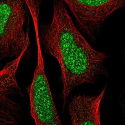 Immunocytochemistry/ Immunofluorescence: RREB1 Antibody [NBP2-56824]