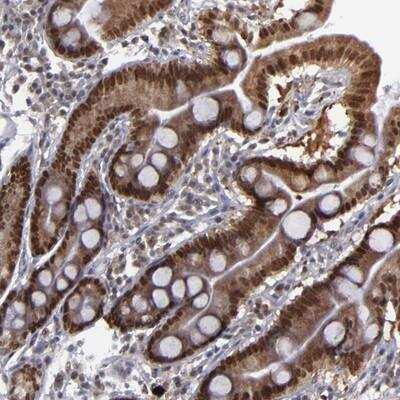 Immunohistochemistry-Paraffin: RREB1 Antibody [NBP1-81726]