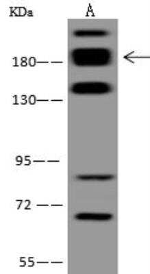 Western Blot: RREB1 Antibody [NBP3-12657]