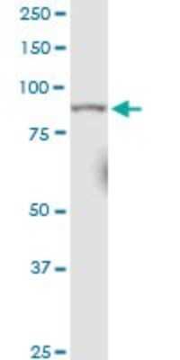 Western Blot: RRM1 Antibody (1D6) [H00006240-M04]