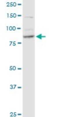 Western Blot: RRM1 Antibody (1D6) [H00006240-M04]