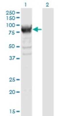 Western Blot: RRM1 Antibody (1D6) [H00006240-M04]