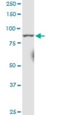 Western Blot: RRM1 Antibody (2D11) [H00006240-M08]