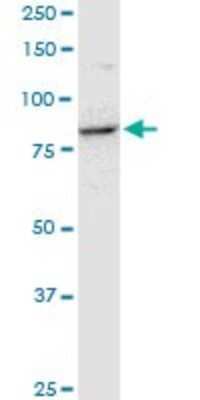 Western Blot: RRM1 Antibody (2D11) [H00006240-M08]