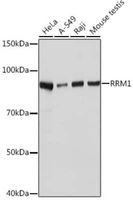 Western Blot: RRM1 Antibody (4P4U1) [NBP3-16364]