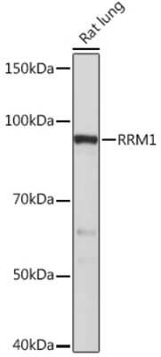 Western Blot: RRM1 Antibody (4P4U1) [NBP3-16364]