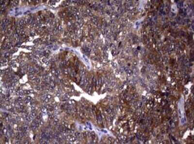 Immunohistochemistry: RRM1 Antibody (OTI5G5) [NBP2-45964]