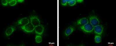 Immunocytochemistry/ Immunofluorescence: RRM1 Antibody [NBP2-20231]