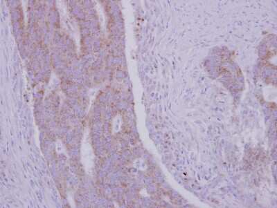 Immunohistochemistry-Paraffin: RRM1 Antibody [NBP2-20231]