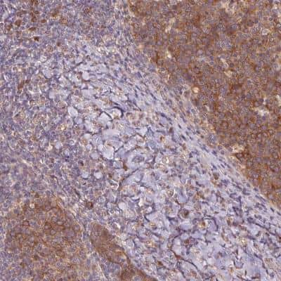 Immunohistochemistry-Paraffin: RRM1 Antibody [NBP2-49415]