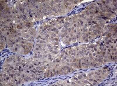 Immunohistochemistry: RRM1 Antibody (OTI5G5) - Azide and BSA Free [NBP2-73947]
