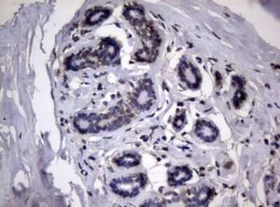 Immunohistochemistry: RRM1 Antibody (OTI5G5) - Azide and BSA Free [NBP2-73947]