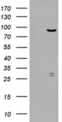 Western Blot: RRM1 Antibody (OTI5G5)Azide and BSA Free [NBP2-73947]