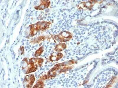 Immunohistochemistry-Paraffin: RRM1 Antibody (RRM1/4372R) - Azide and BSA Free [NBP3-08331]