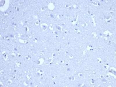 Immunohistochemistry-Paraffin: RRM1 Antibody (RRM1/4372R) - Azide and BSA Free [NBP3-08331]