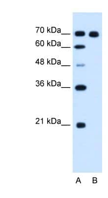 Western Blot: RRM1 Antibody [NBP1-58069]