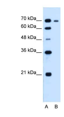 Western Blot: RRM1 Antibody [NBP1-58187]