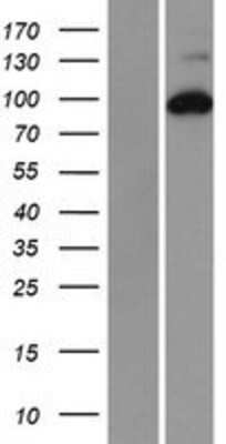 Western Blot: RRM1 Overexpression Lysate [NBP2-08619]