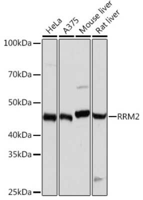 Western Blot: RRM2 Antibody (10Y6E4) [NBP3-16182]