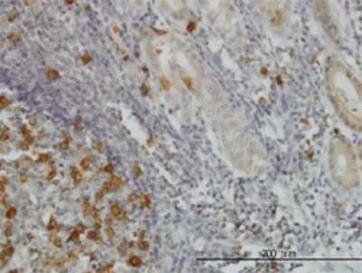 Immunohistochemistry-Paraffin: RRM2 Antibody (1E1) [H00006241-M01]