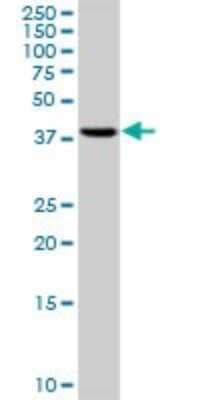 Western Blot: RRM2 Antibody (1E1) [H00006241-M01]