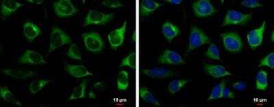 Immunocytochemistry/ Immunofluorescence: RRM2 Antibody [NBP1-31661]