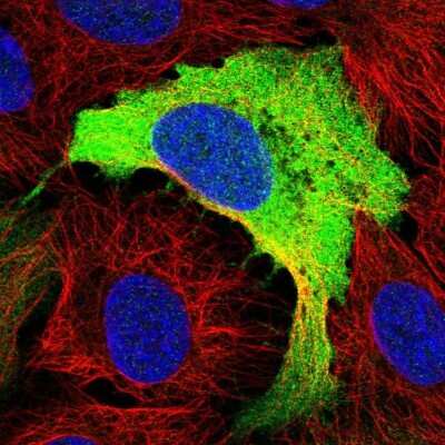 Immunocytochemistry/ Immunofluorescence: RRM2 Antibody [NBP2-47294]