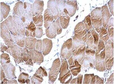 Immunohistochemistry-Paraffin: RRM2 Antibody [NBP1-31661]