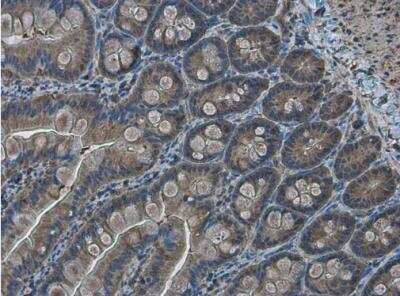 Immunohistochemistry-Paraffin: RRM2 Antibody [NBP1-31661]