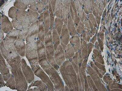 Immunohistochemistry-Paraffin: RRM2 Antibody [NBP1-31661]