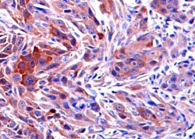 Immunohistochemistry-Paraffin: RRM2 Antibody [NBP1-31661]