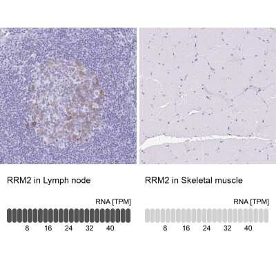 Immunohistochemistry-Paraffin: RRM2 Antibody [NBP2-47294]