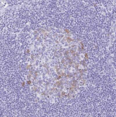 Immunohistochemistry-Paraffin: RRM2 Antibody [NBP2-47294]