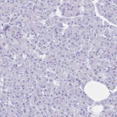 Immunohistochemistry-Paraffin: RRM2 Antibody [NBP2-47294]