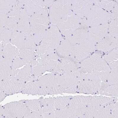 Immunohistochemistry-Paraffin: RRM2 Antibody [NBP2-47294]