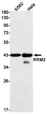 Western Blot: RRM2 Antibody (S09-4G8) [NBP3-14973]