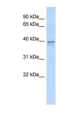 Western Blot: RRM2 Antibody [NBP1-58189]