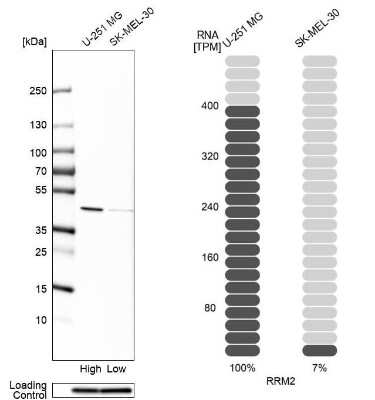 Western Blot: RRM2 Antibody [NBP2-47294]
