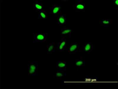 Immunocytochemistry/ Immunofluorescence: RRN3 Antibody [H00054700-B01P]