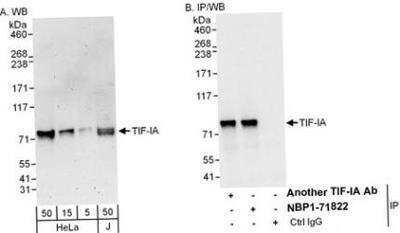 Western Blot: RRN3 Antibody [NBP1-71822]