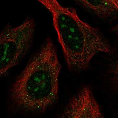 Immunocytochemistry/ Immunofluorescence: RRNAD1 Antibody [NBP2-13268]