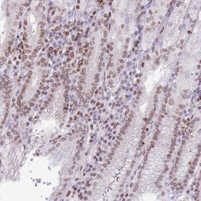 Immunohistochemistry-Paraffin: RRNAD1 Antibody [NBP2-13268]