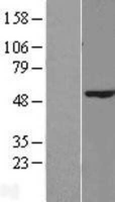 Western Blot: RRNAD1 Overexpression Lysate [NBL1-08328]