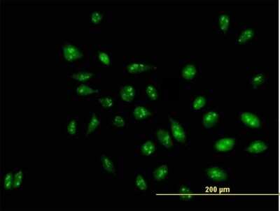 Immunocytochemistry/ Immunofluorescence: RRP1 Antibody [H00008568-B01P]
