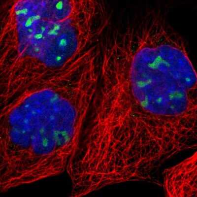 Immunocytochemistry/ Immunofluorescence: RRP1 Antibody [NBP1-85339]