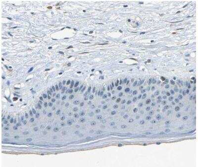 Immunohistochemistry-Paraffin: RRP1 Antibody [NBP1-85338]