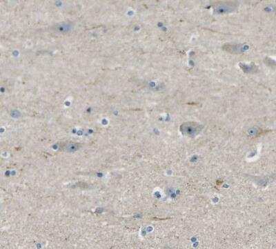 Immunohistochemistry-Paraffin: RRP1 Antibody [NBP1-85338]