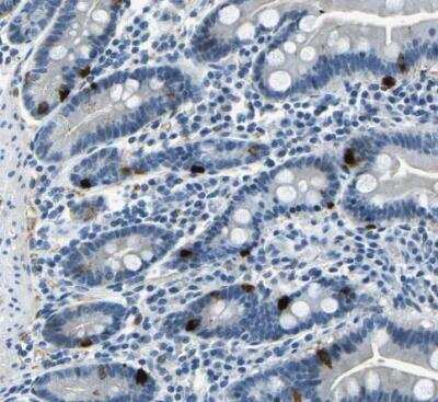 Immunohistochemistry-Paraffin: RRP1 Antibody [NBP1-85338]